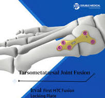 ✨Double Medical Itval Foot & Ankle System🦶✨ The ITVAL ...