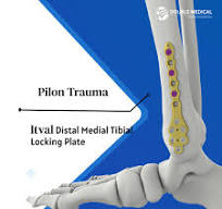 ✨Double Medical Itval Foot & Ankle System🦶✨ The ITVAL ...