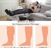 Amazon.com: LONGEST Lymphedema Pumps Legs Foot Compression ...