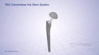 TBG Cementless Hip Stem System