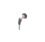 Alter Cementless Stem,Medical Device Manufacturers -Double ...