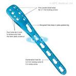 fixLOCK Distal Lateral Fibula Plate Manufacturer & Supplier ...