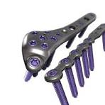 A.L.P.S.® Distal Fibula Plating System Surgical Technique
