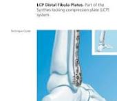 LCP Distal Fibula Plates - Depuy Synthes - PDF Catalogs ...