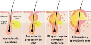 Glándulas sebáceas., Las responsables de... - Eternal youth skin care |  Facebook