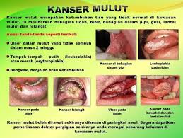 Account Suspended Info Cara Dan