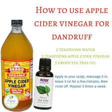 6 Powerful Ways To Prevent Dandruff Naturally Enjoy Natural Health Apple Cider Vinegar Remedies Dandruff Remedy Getting Rid Of Dandruff