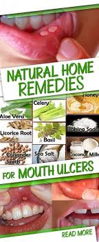 Natural Home Remedies For Mouth Ulcers Mouth Ulcers Ulcer Remedies Mouth Natural Oral Care