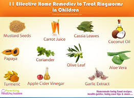 Ringworm In Kids Symptoms Causes Home Remedies Ultimate Guide Home Remedies For Ringworm Home Remedies Ringworm Remedies
