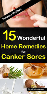 15 Canker Sore Relief Remedies That Work Canker Sore Remedy Canker Sore Canker Sore On Gum