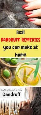 Best Dandruff Remedies You Can Make At Home Home Remedies For Dandruff Dandruff Remedy Thick Hair Remedies