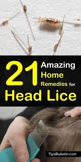 21 Natural Remedies For Head Lice Natural Cough Remedies Remedies Natural Home Remedies