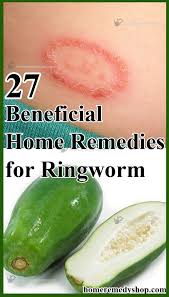 23 Beneficial Home Remedies For Ringworm Home Remedies For Ringworm Remedies Home Remedies