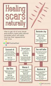 Pin On Chemical Free Living