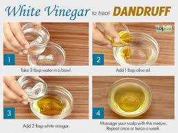 Home Remedies For Dandruff Top 10 Home Remedies Home Remedies For Dandruff Dandruff Remedy Hair Dandruff