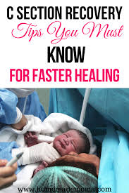 C Section Delivery Recovery Tips In 2020 C Section Recovery Postpartum Care Kit C Section