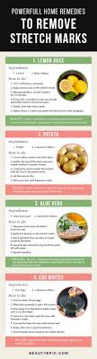 Home Remedies For Stretch Marks 8 Easy To Remove Stretch Marks Stretch Mark Remedies Stretch Marks Stretch Mark Removal