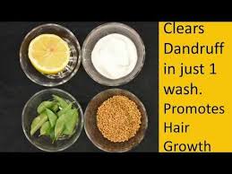 Clears Dandruff In One Wash Dandruff Treatment At Home Home Remedy For Dandruff You Home Remedies For Dandruff Dandruff Remedy Dandruff Treatment At Home