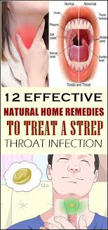 12 Effective Natural Home Remedies To Treat A Strep Throat Infection Throat Infection Strep Throat Natural Headache Remedies