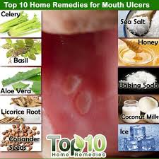 Home Remedies For Mouth Ulcers Emedihealth Mouth Ulcers Mouth Sores Ulcer Remedies Mouth