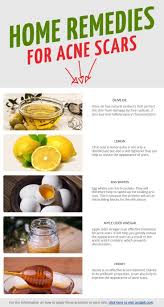 Pin On How To Get Rid Of Acne