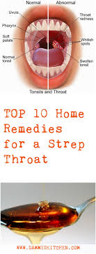 Strep Throat 10 Natural Remedies Health Remedies Nature Healthylife Strep Throat Remedies Natural Health Tips