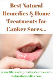 How To Get Rid Of A Canker Sore Fast 10 Natural Overnight Remedies For Mouth Ulcers That Work A Treat Canker Sore Remedy Canker Sore Canker Sore Treatment