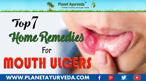 Top 7 Best Home Remedies For Mouth Ulcers Canker Sores Mouth Ulcers Are Small Painful Lesions That Devel Ulcer Remedies Mouth Mouth Ulcers Ulcers