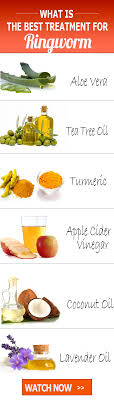 17 Diy Home Remedies For Ringworm Ringworm Is A Common Fungus Infection Of The Skin Natural Treatment Home Remedies For Ringworm Ringworm Remedies Remedies