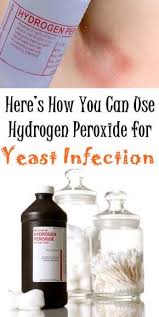 Here S How You Can Use Hydrogen Peroxide For Yeast Infection Treat Yeast Infection Yeast Infection Home Remedy Yeast Infection Cure