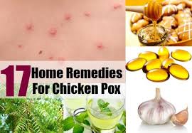 Pin On Home Remedy