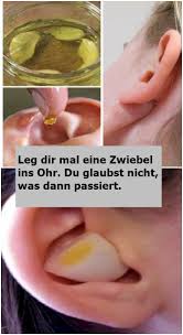 Leg Dir Mal Eine Zwiebel Ins Ohr Du Glaubst Nicht Was Dann Passiert Heilen Ohr Gesundheit Und Wohlbefinden