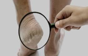 Pin On أمراض وعلاجات