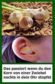 Das Passiert Wenn Du Den Kern Von Einer Zwiebel Nachts In Dein Ohr Stopfst Mit Bildern Zwiebel Ohr Gesundheit