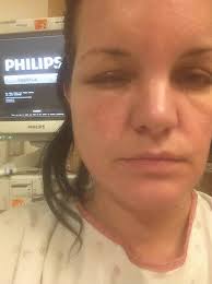 Ncis Star Pauley Perrette Lands In Hospital After Severe Allergic Reaction To Hair Dye Hair Dye Allergy Dyed Hair Black Hair Dye