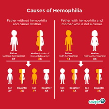 Hemophilia Types Definition Genetics Treatment Disability