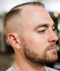 44 Mind Blowing Haircuts For Balding Men Trendiest In 2019 Haircuts For Balding Men Thin Hair Men Balding Mens Hairstyles