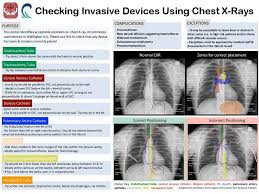 Positioning Of Lines And Tubes On Chest X Rays Foamed Radiology Radiology Imaging X Ray