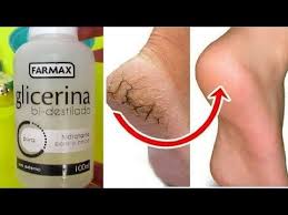 Acabe Com Rachaduras Nos Pes Em 3 Dias Usando Glicerina Youtube Hidratacao Com Glicerina Rachaduras Nos Pes Cuidado Com Os Pes