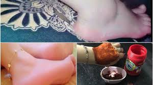 علاج تشققات القدمين علاج تشققات القدمين الشديدة علاج تشقق القدمين الشديد Body Care Body Silver Rings