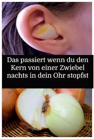 Das Passiert Wenn Du Den Kern Von Einer Zwiebel Nachts In Dein Ohr Stopfst Vegetables Garlic Food