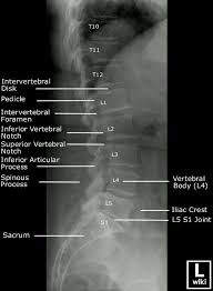 X Ray Of The Lower Back Showing Vertebrae Radiology Imaging Radiology Student Radiology Technologist