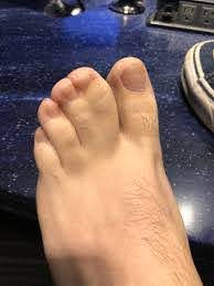 #footfetish #feetlovers #webbedtoes #sexyfeet #footworshi̇p pic.twitter.com/iymrsgnuez. Jim Sam On Twitter Handsome Rob S Webbed Toes