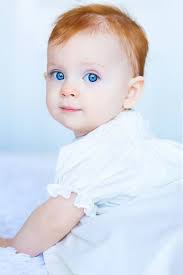 This disorder is caused by a gene mutation. The Big Question Will You Have A Redhead Baby How To Be A Redhead