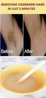 Apply aloe vera gel on the armpit rash. Removing Underarm Hairs In Just 2 Minutes Underarm Hair How To Remove Beauty Hacks