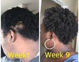 #organic hair care #organic natural hair growth #black hair growth #natural hair care products #thinning edges remedy. Pin By Sibi On Hair In 2020 Hair Growth Cream Hair Growth Faster Hair Loss Growth