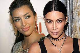 Her hair color seen is in both blonde. Kim Kardashian Admits She Had Hairline Lasered To Get Rid Of Baby Hairs That Made Her Break Out Mirror Online