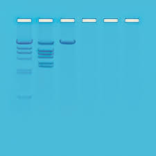 Ap09 Lab 9 Biotechnology Restriction Enzyme Analysis Of Dna Dna Electrophoresis Stem Experiments Biology Labs