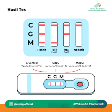 Interpretasi Hasil Pemeriksaan Rapid Test Dan Swab Rt Pcr Rumah Sakit Mitra Plumbon