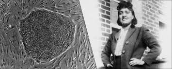 Vessels For Collective Progress The Use Of Hela Cells In Covid 19 Research Science In The News
